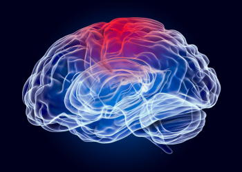 X-Ray Graphic of Brain with a Concussion